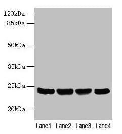 EMC8 / COX4NB Antibody