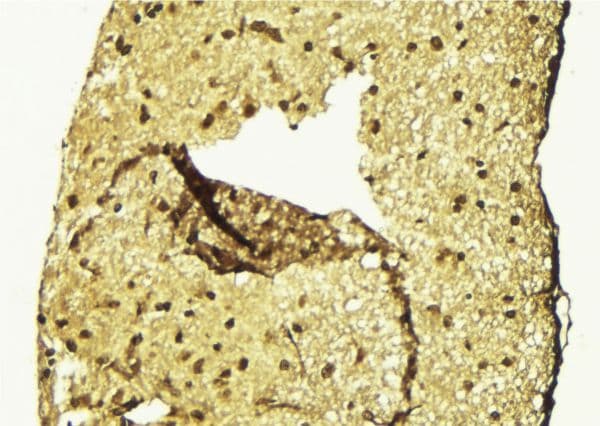 FOSL2 / FRA-2 Antibody