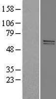 ADCK5 Protein (Over-Expression Lysate Myc-DDK (Flag))