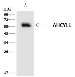 Polyclonal Rabbit anti-Human AHCYL1 / DCAL Antibody (IHC, IF, WB)