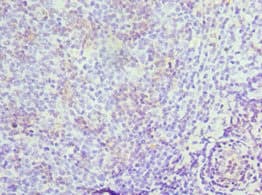 MRE11A / MRE11 Antibody (aa1-205)