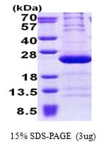 Human RPL11 / Ribosomal Protein L11 (Recombinant His)
