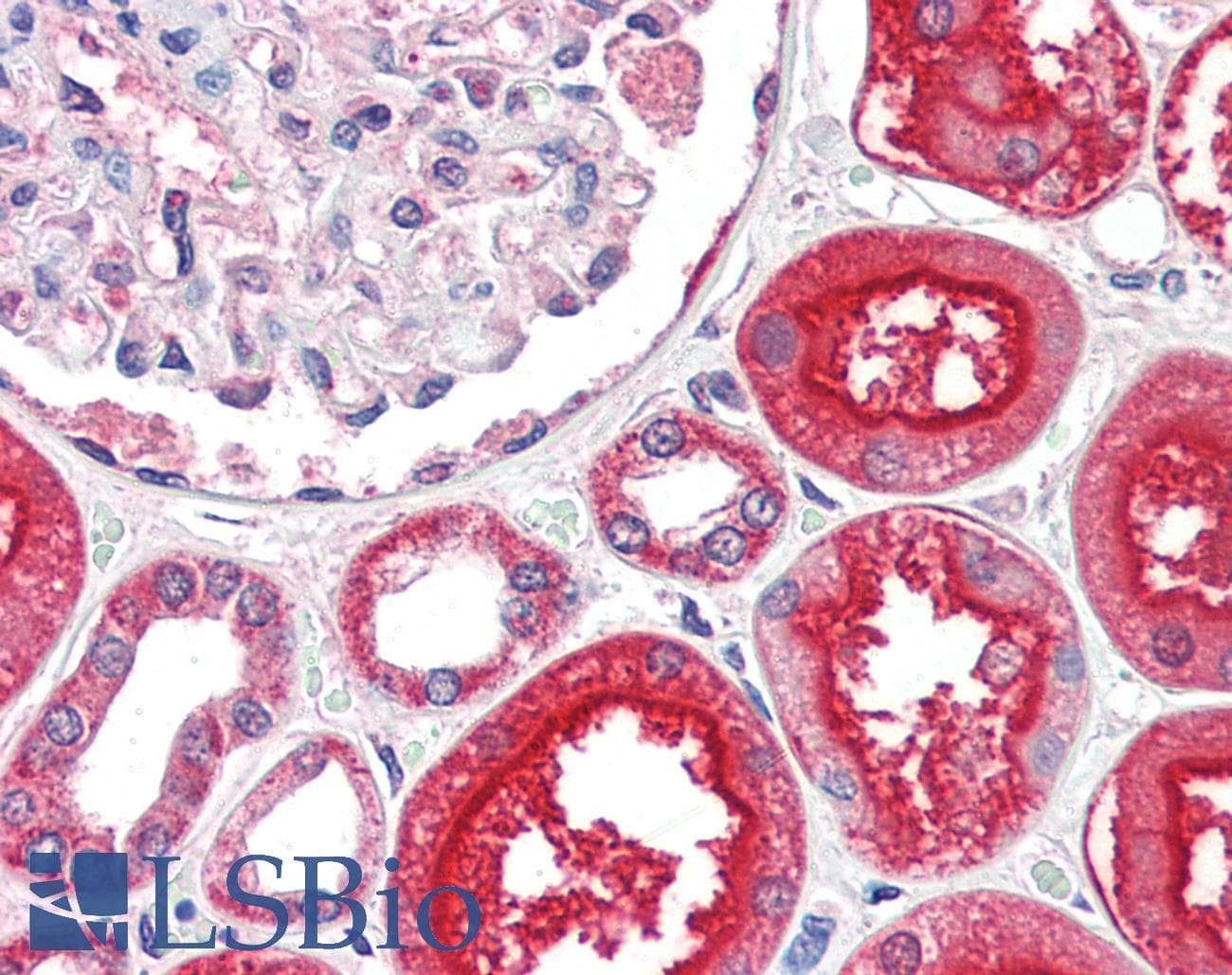 PathPlus™ Polyclonal Rabbit anti-Human ACE2 / ACE-2 Antibody (IHC, IF, WB)