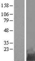 TMEM258 / C11orf10 Protein (Over-Expression Lysate Myc-DDK (Flag))