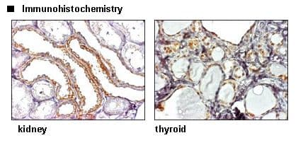 SLC7A3 / CAT-3 Antibody