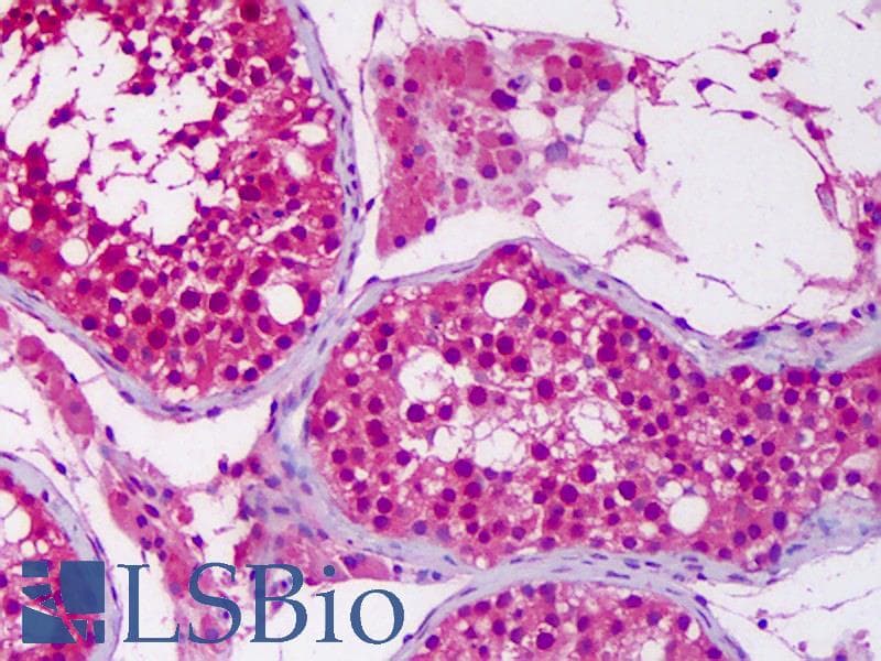 IHC-plus™ Monoclonal Mouse anti-Human UBE1L2 / UBE1L2 Antibody (clone 1D11, IHC, WB)
