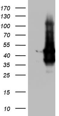 TACC2 Antibody (aa727-1026, clone OTI3G1)