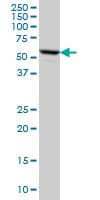 FKBP4 / FKBP52 Antibody (clone 5C11)