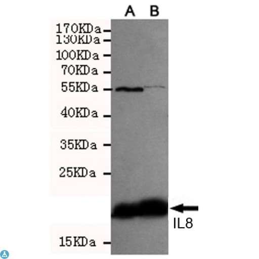 IL8 / Interleukin 8 Antibody