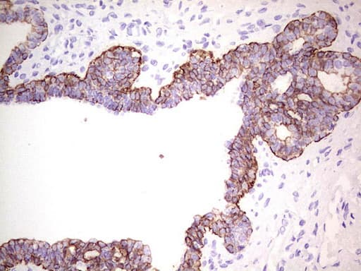 KRT19 / CK19 / Cytokeratin 19 Antibody (aa240-390, clone UMAB186)