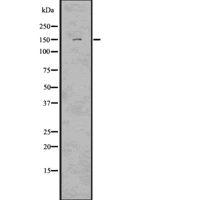LATS2 Antibody