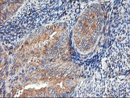 TUBAL3 Antibody (aa150-446, clone OTI1G6, Carrier-free)