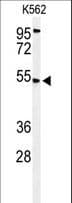 MICU1 / CBARA1 Antibody (aa52-81)