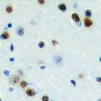 Polyclonal Rabbit anti-Human ZC3H7B Antibody (C-Terminus, IHC, WB)
