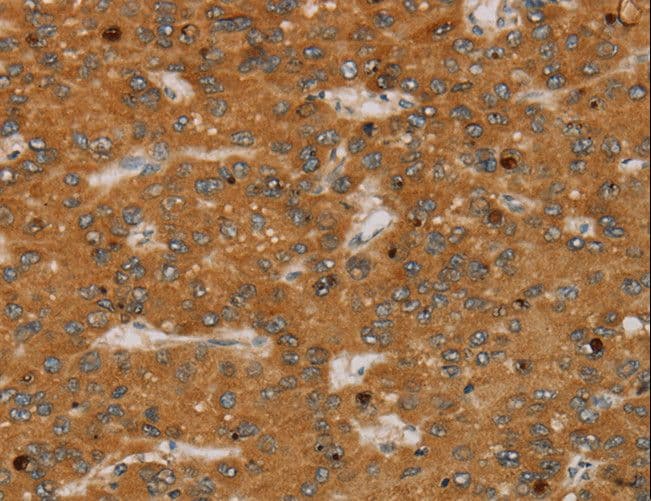 Polyclonal Rabbit anti-Human PARP3 Antibody (IHC)
