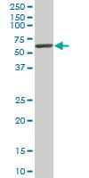 USP14 Antibody (clone 1F8)