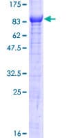 Human TTC39B Protein (Recombinant GST)