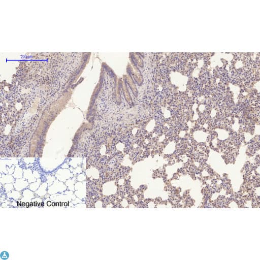 Polyclonal Rabbit anti-Human APP / Beta Amyloid Precursor Antibody (WB)