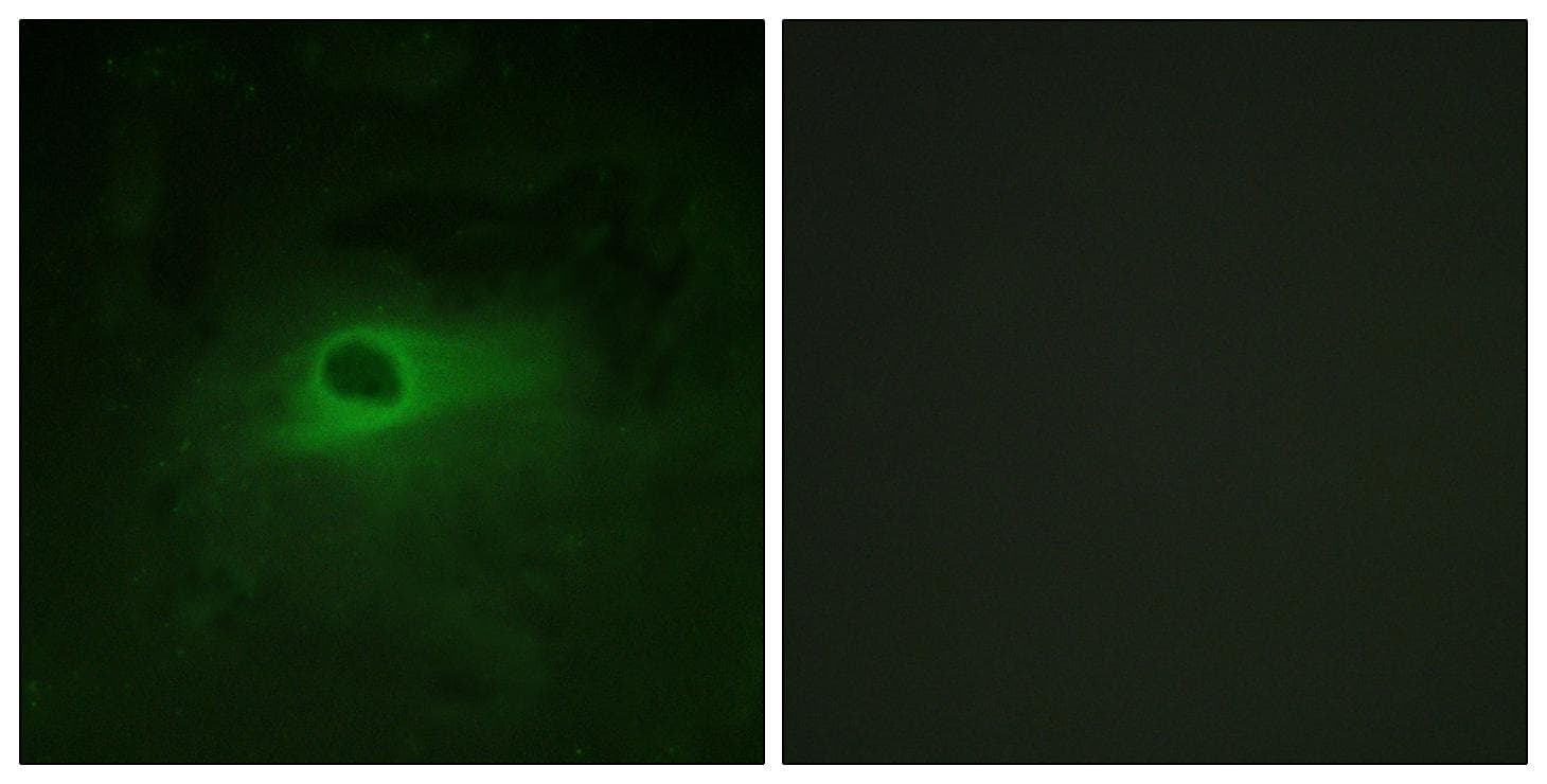 CSF1R / CD115 / FMS Antibody (p809)