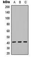 KIR2DL5A / KIR2DL5 Antibody (Internal)