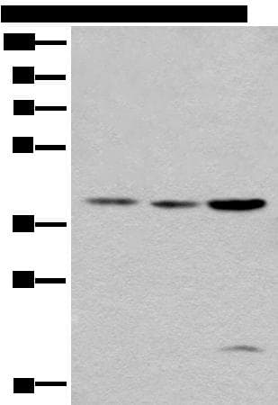 Polyclonal Rabbit anti-Human ROM1 Antibody (IHC, WB)