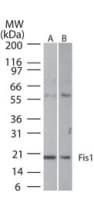 IHC-plus™ Polyclonal Rabbit anti-Human FIS1 Antibody (aa11-25, IHC, WB)