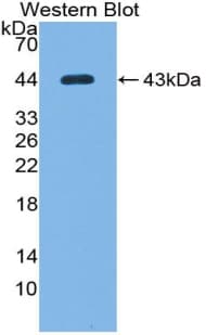 Complement C7 Antibody (aa122-456, FITC)