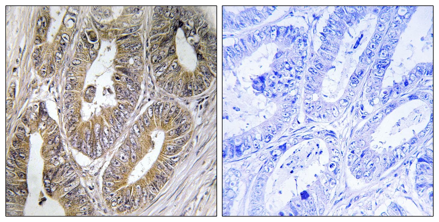 Polyclonal Rabbit anti-Human Cystatin SA / CST2 Antibody (IHC)