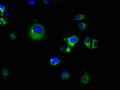 PRSS8 / Prostasin Antibody