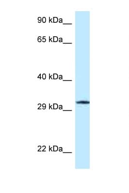 GMPR1 / GMPR Antibody (aa273-322)
