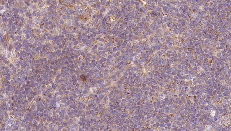Polyclonal Rabbit anti-Human TMOD1 / Tropomodulin 1 Antibody (IHC, IF, WB)