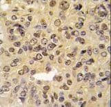 MEN1 / Menin Antibody (Ser128)