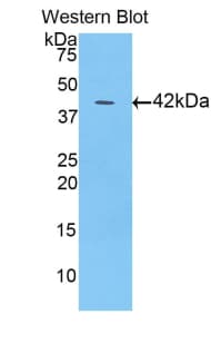 FABP3 / H-FABP Antibody (aa1-133)