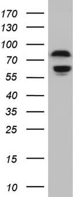 Polyclonal Rabbit anti-Human RELA / NFKB p65 Antibody (aa100-170, IHC, WB)
