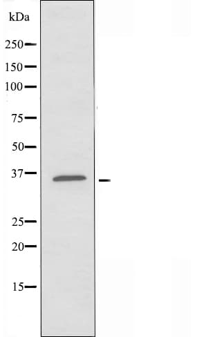 Polyclonal Rabbit anti-Human LSP1 Antibody (IF, WB)