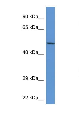 ACP2 / Acid Phosphatase 2 Antibody (aa80-129)