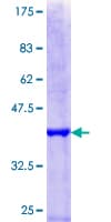 Human HIRA Protein (Recombinant GST, N-terminus)