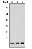 Polyclonal Rabbit anti-Human NRG4 Antibody (Internal, WB)