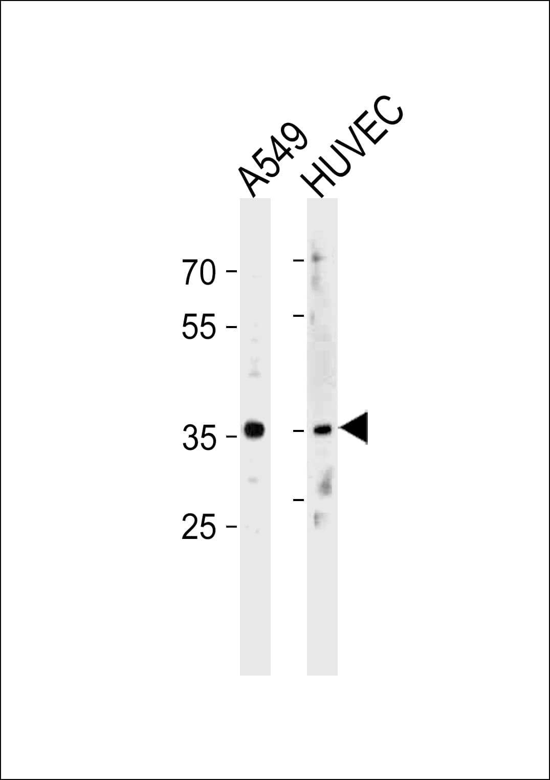 HOXB5 Antibody (aa193-222)