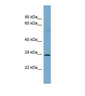 SNAI1 / SNAIL-1 Antibody (N-Terminus)