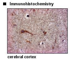 SLC6A15 / SBAT1 Antibody (N-Terminus)