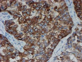 Monoclonal Mouse anti-Human SENP2 Antibody (clone OTI6F1, IHC, IF, WB)