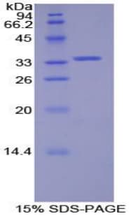 Human SYK Protein (Recombinant His-T7)