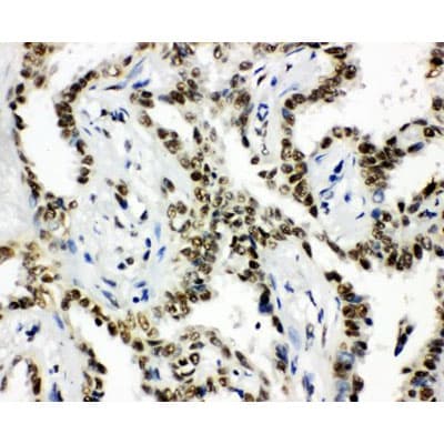 Polyclonal Rabbit anti-Human HDAC3 Antibody (aa1-18, IHC, WB)