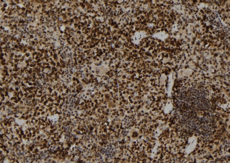 Polyclonal Rabbit anti-Human PAD2 / PADI2 Antibody (IHC, IF, WB)