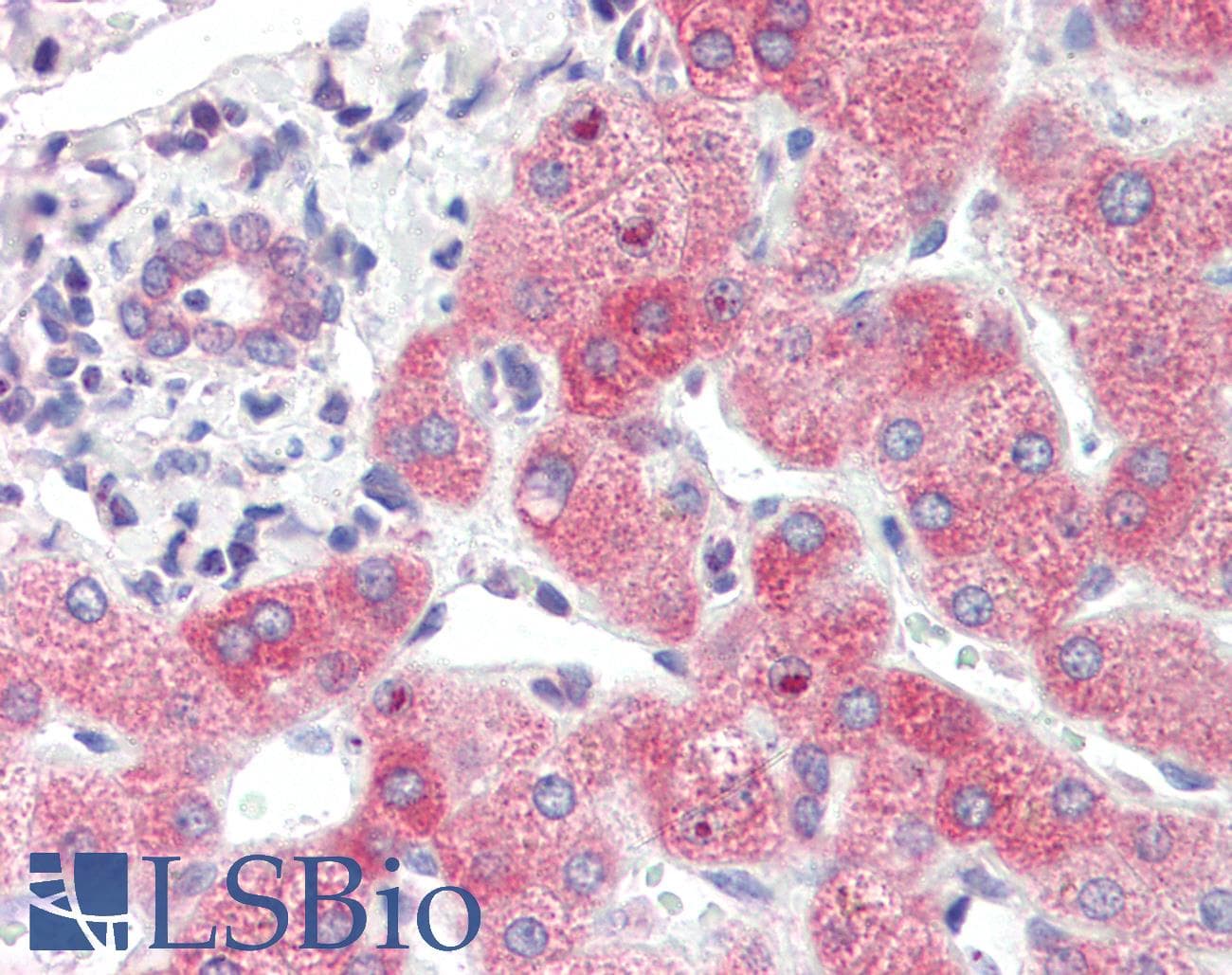 IHC-plus™ Polyclonal Rabbit anti-Human SYVN1 / HRD1 Antibody (aa586-617, IHC, IF, WB)