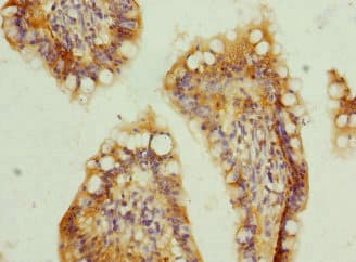 Polyclonal Rabbit anti-Human TMEM91 Antibody