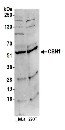 GPS1 / CSN1 Antibody (aa400-C-term)