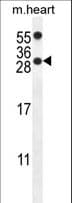 Polyclonal Rabbit anti-Human PPP1R14C / KEPI Antibody (aa126-155, IHC, WB)