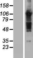 TBC1D5 Protein (Over-Expression Lysate Myc-DDK (Flag))